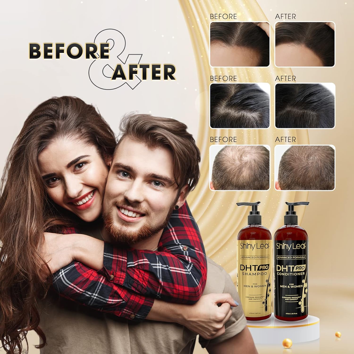 DHT Pro Shampoo and Conditioner with Procapil and Capixyl